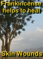 Ormus Rich Ionic Colloidal Silver Skin Cream with Frankincense Ormus Rich Ionic Colloidal Silver Skin Cream with Frankincense